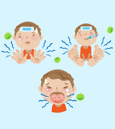 The Insufferable Hand Foot and Mouth Disease, How to Protect Your Child